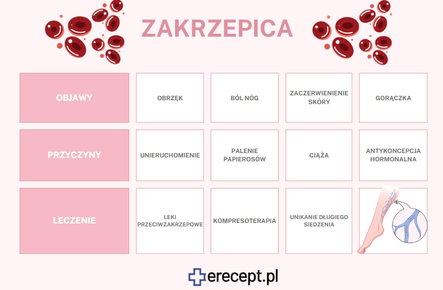 zakrzepica-infografika-erecept